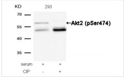 AKT2, p Ser474 Antibody, Novus Biologicals:Antibodies:Primary Antibodies